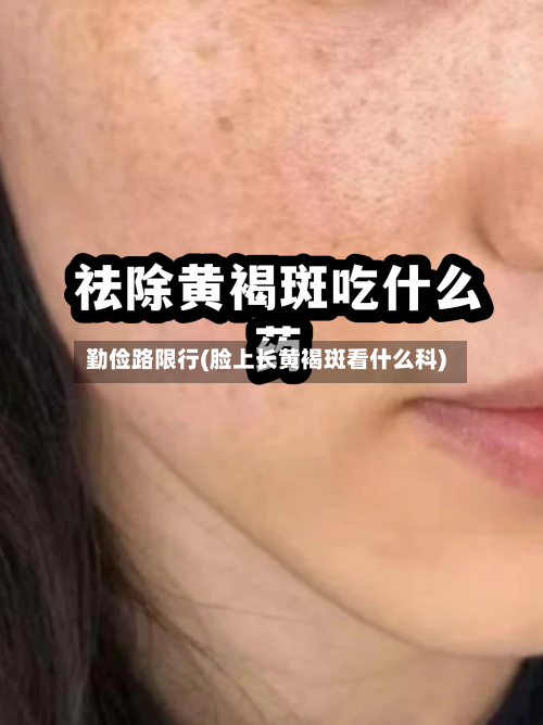 勤俭路限行(脸上长黄褐斑看什么科)