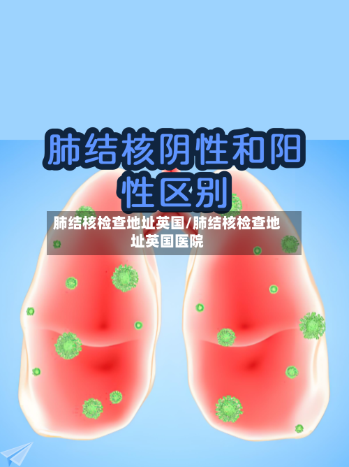 肺结核检查地址英国/肺结核检查地址英国医院
