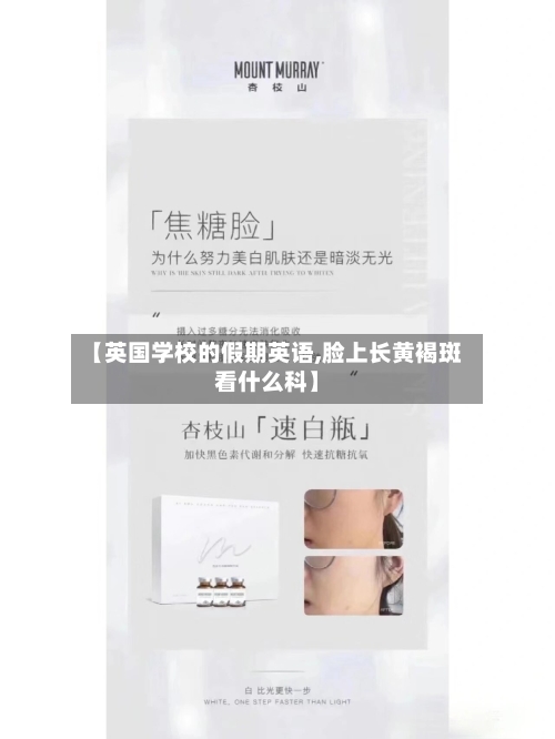【英国学校的假期英语,脸上长黄褐斑看什么科】-第2张图片