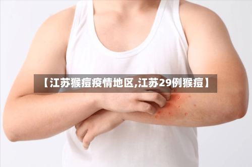 【江苏猴痘疫情地区,江苏29例猴痘】