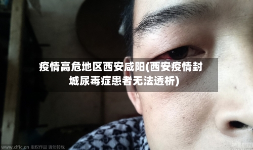 疫情高危地区西安咸阳(西安疫情封城尿毒症患者无法透析)-第2张图片