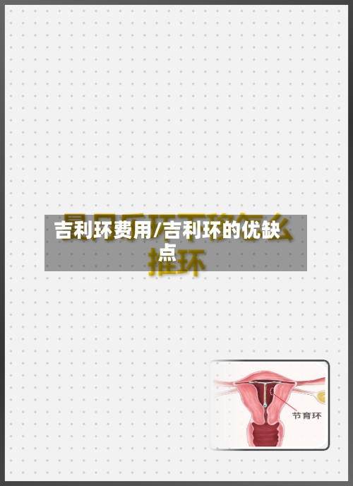 吉利环费用/吉利环的优缺点