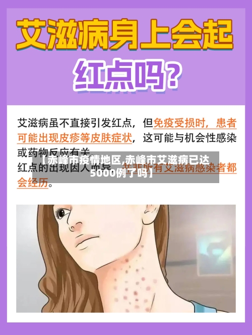 【赤峰市疫情地区,赤峰市艾滋病已达5000例了吗】