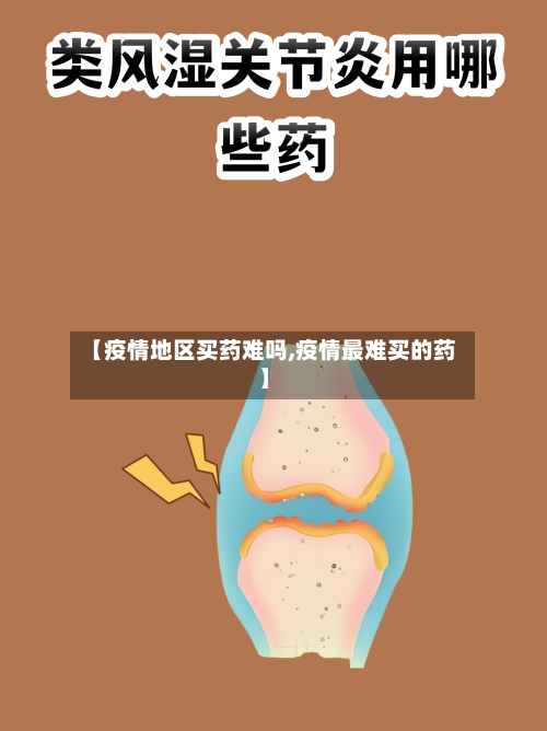 【疫情地区买药难吗,疫情最难买的药】-第2张图片