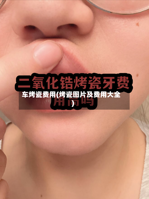车烤瓷费用(烤瓷图片及费用大全)